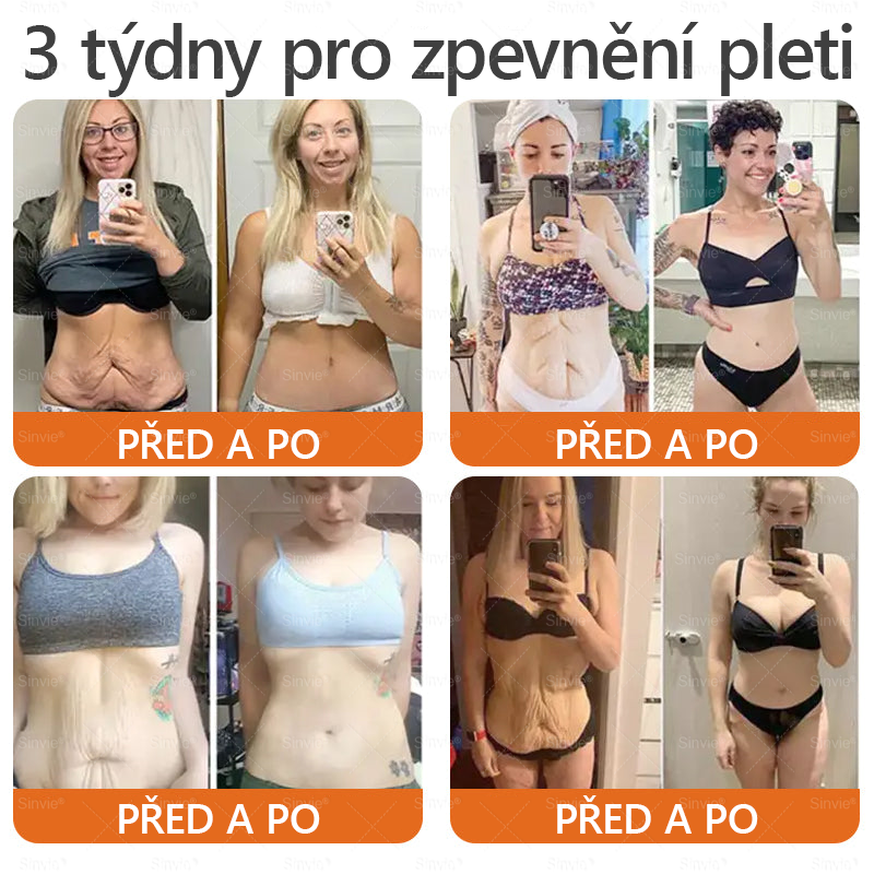 Sinvie® Krém na obnovu pleti s včelím jedem | 50 ml | Doporučeno Českou dermatovenerologickou společností