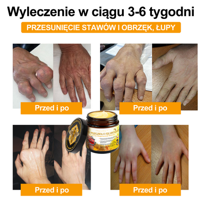 Gbpurity™ Krem Do Regeneracji Stawów|ZAWIERA PEPTYD PSZCZELI, GLUKOZAMINĘ I ARNIKĘ