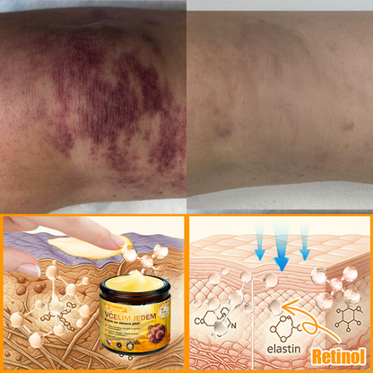 Sinvie® Krém na obnovu pleti s včelím jedem | 50 ml | Doporučeno Českou dermatovenerologickou společností